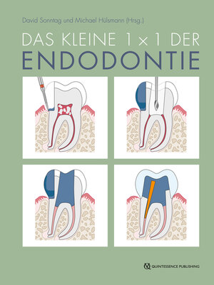 cover image of Das kleine 1x1 der Endodontie